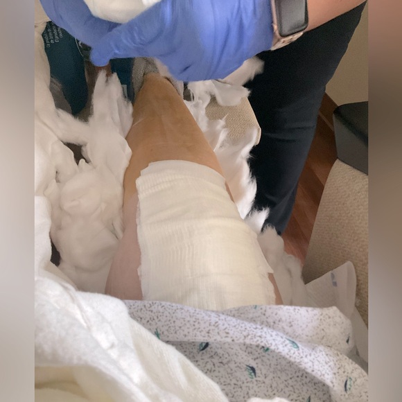 Surgery Update - Picture 3 of 3